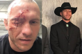 Donald Cowboy Cerrone eye injury makeup