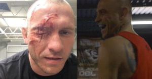 donald cerrone eye