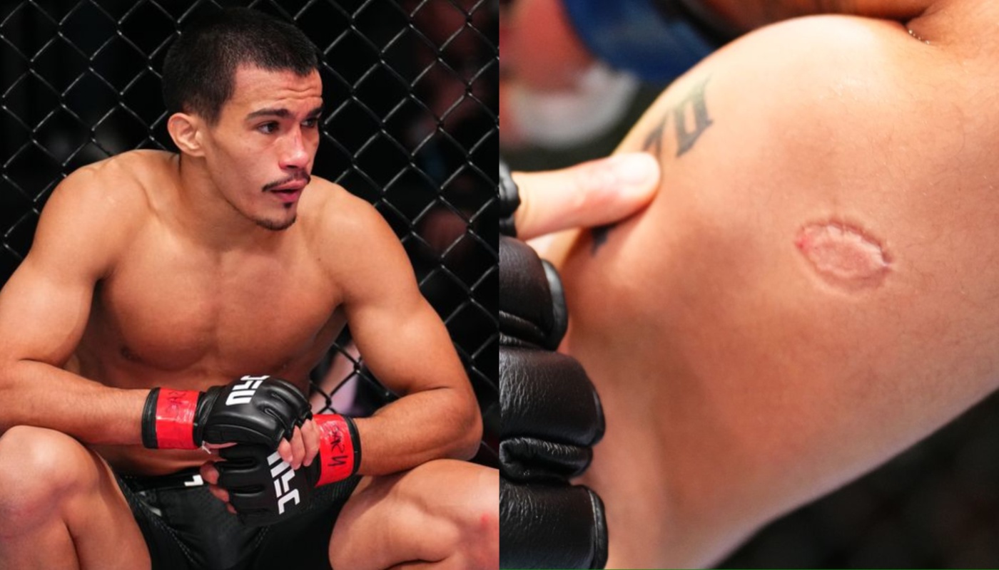 Igor Severino handed a nine-month suspension for biting opponent at UFC  Fight Night event | BJPenn.com